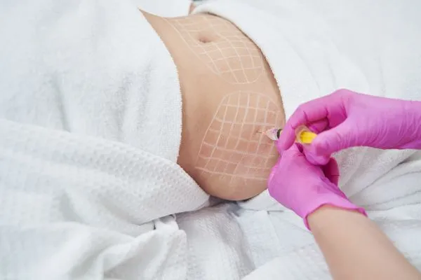image of fat dissolving injections on love handles to help combat weight gain Robroyston