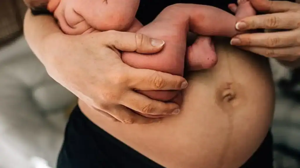 Why Is My Stomach Still Big After Pregnancy Robroyston?